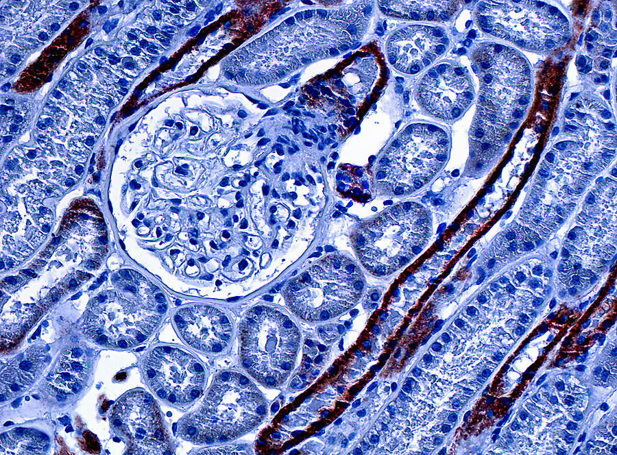 Kidney Cortex, Lm #2 Photograph by Alvin Telser