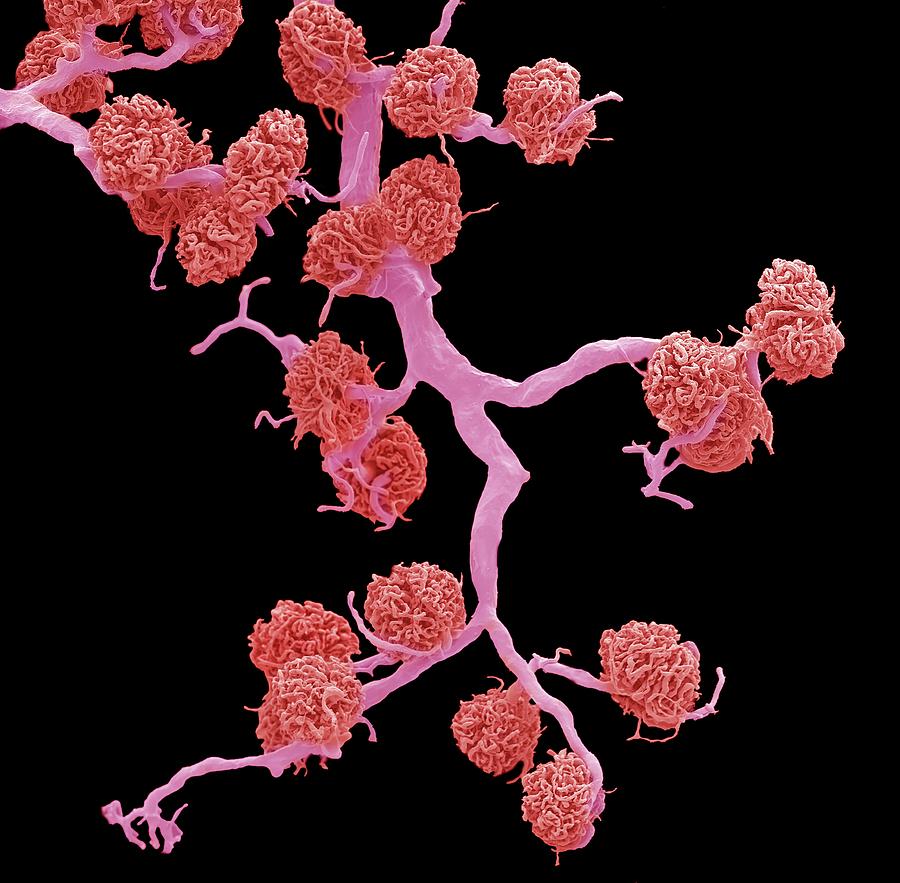 Kidney Glomeruli Photograph by Steve Gschmeissner