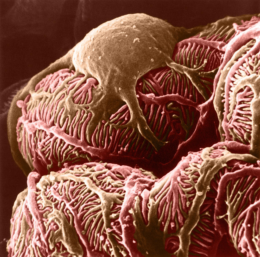 Kidney Glomerulus, Sem #1 Photograph by Don W. Fawcett