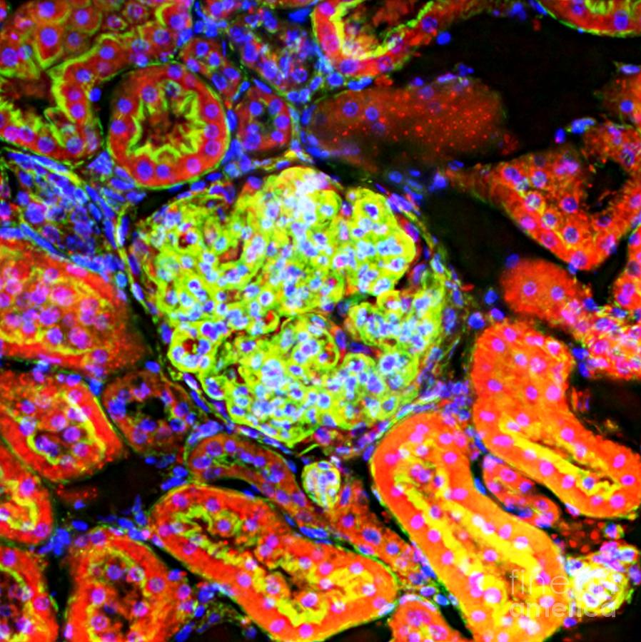 Kidney Tissue, Fluorescence Micrograph Photograph by R. Bick, B ...