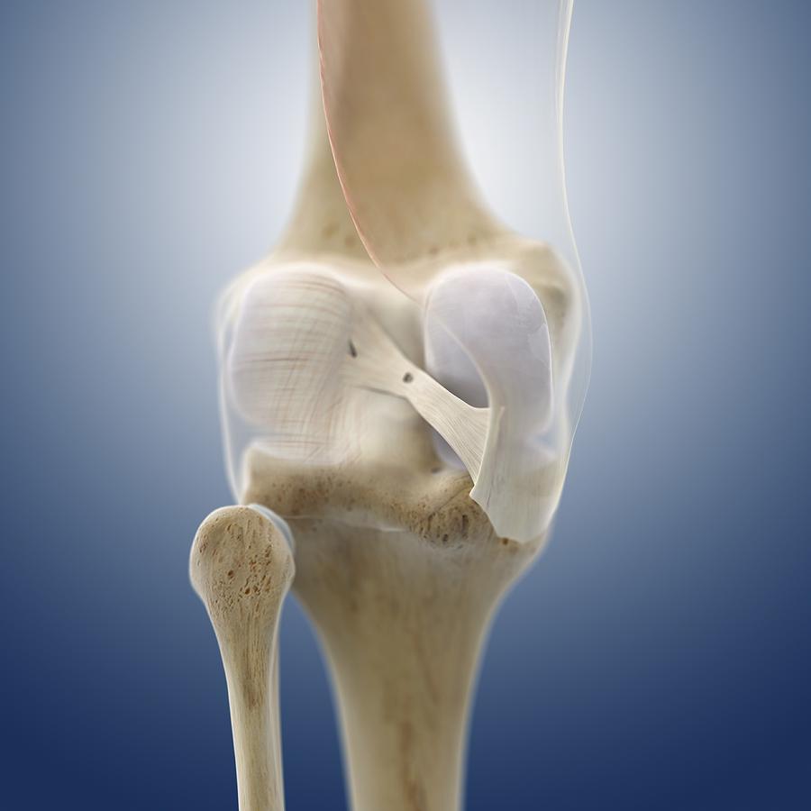 Knee ligaments, artwork Photograph by Science Photo Library - Fine Art ...