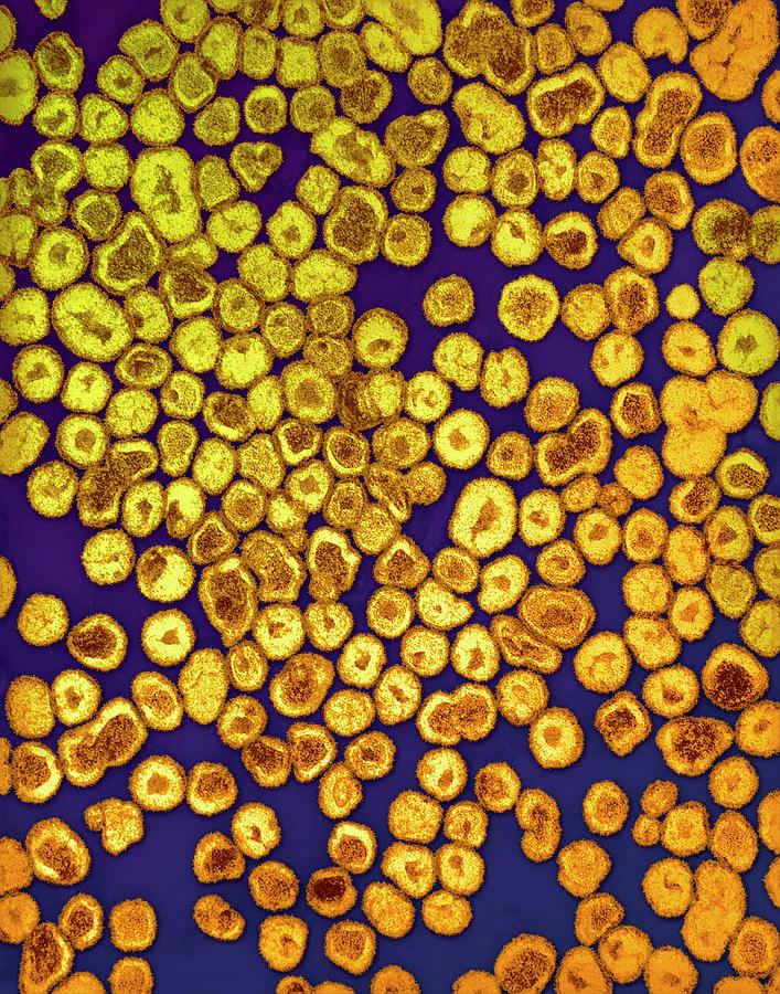 Nature Photograph - La Crosse Virus Particles #1 by Ami Images