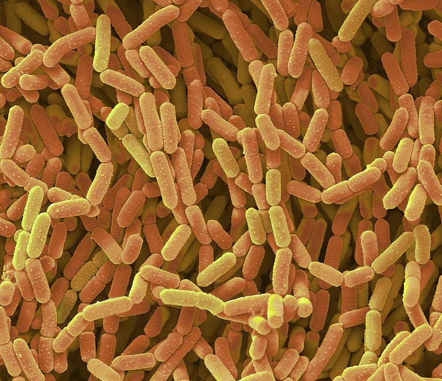 Lactobacillus Rhamnosus Bacteria #1 by Steve Gschmeissner/science Photo  Library