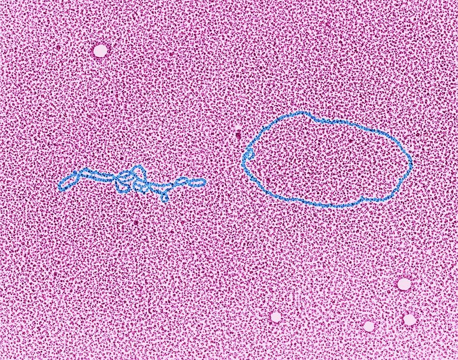 Lambda Phage Dna Photograph by Dennis Kunkel Microscopy ...