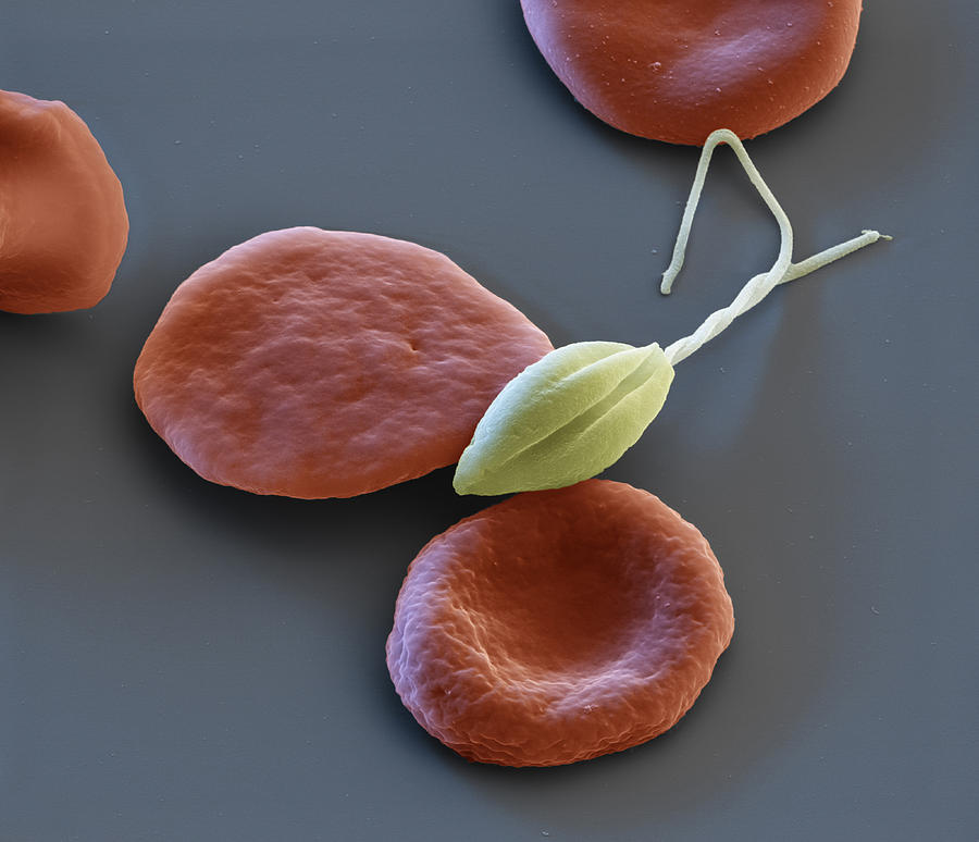 Leishmaniasis And Red Blood Cell, Sem #1 Photograph by Eye of Science