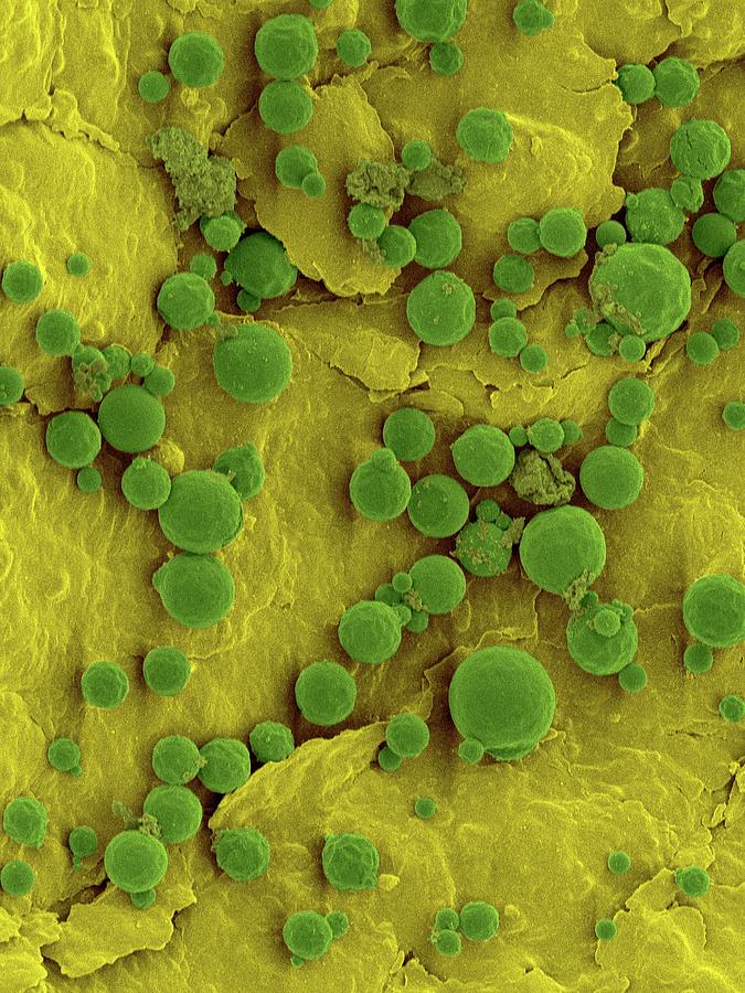 Lemon Surface With Yeast #1 Photograph by Science Photo Library Lemon Surface With Yeast #1 Photograph by Science Photo Library