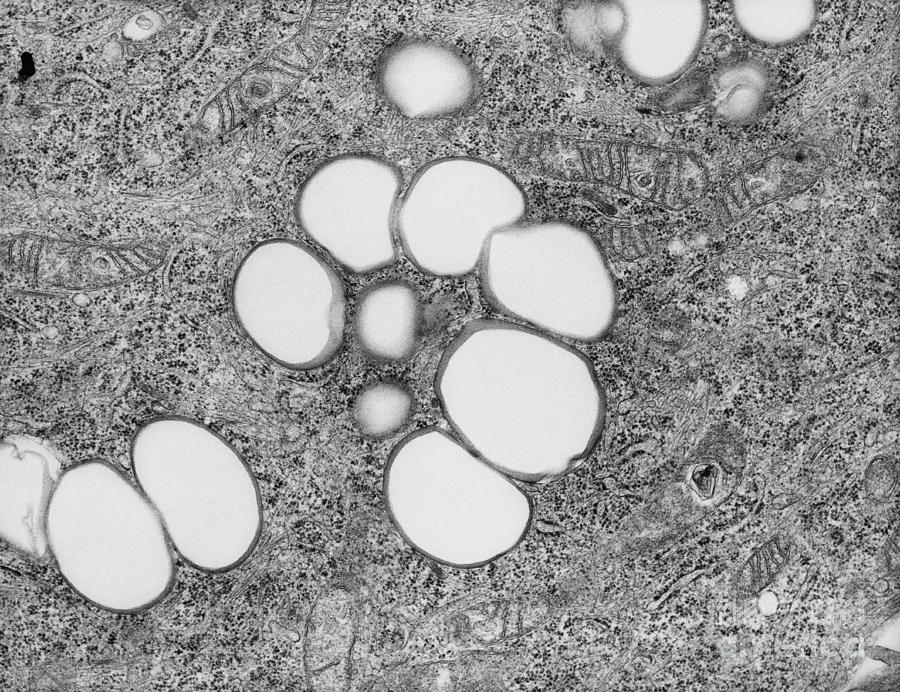 Lipid Cells, Tem #1 Photograph by David M. Phillips
