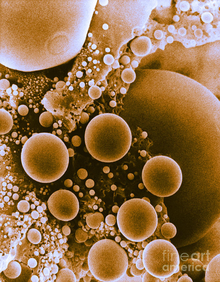 Lipid Droplets, Sem #1 Photograph by David M. Phillips