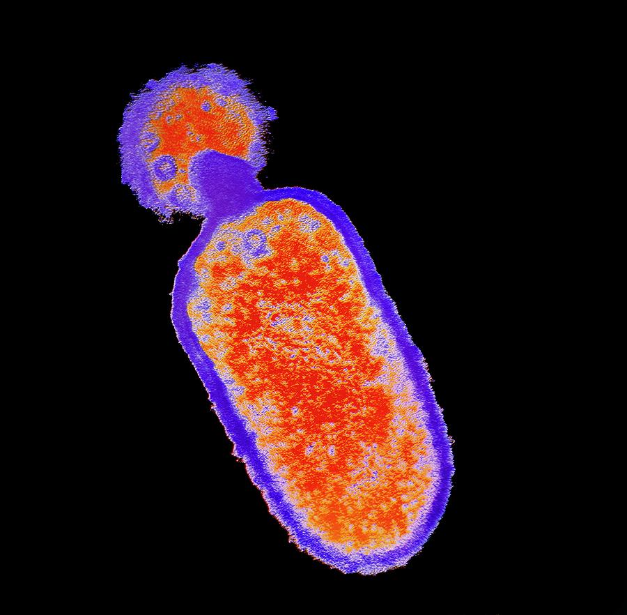 Listeria Monocytogenes Photograph - Listeria Monocytogenes Bacterium #1 by Dr Kari Lounatmaa/science Photo Library