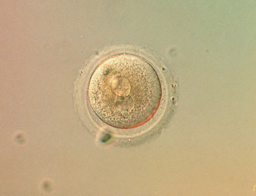 1-lm-of-human-zygote-during-in-vitro-fertilisation-cc-studioscience-photo-library.jpg