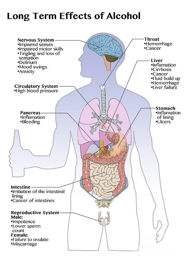 long-term-effects-of-alcohol-alcoholism-royalty-free-vector