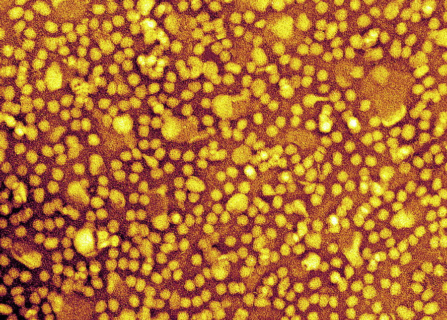 Low-desity Lipoproteins #1 Photograph by Science Photo Library