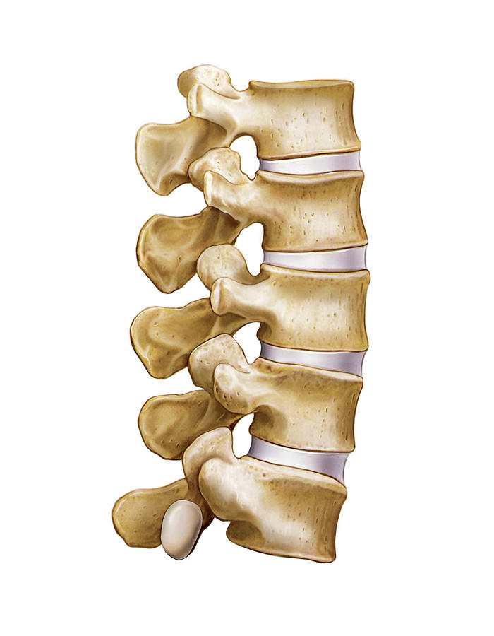 Lumbar Part Of Vertebral Column Photograph by Asklepios Medical Atlas ...