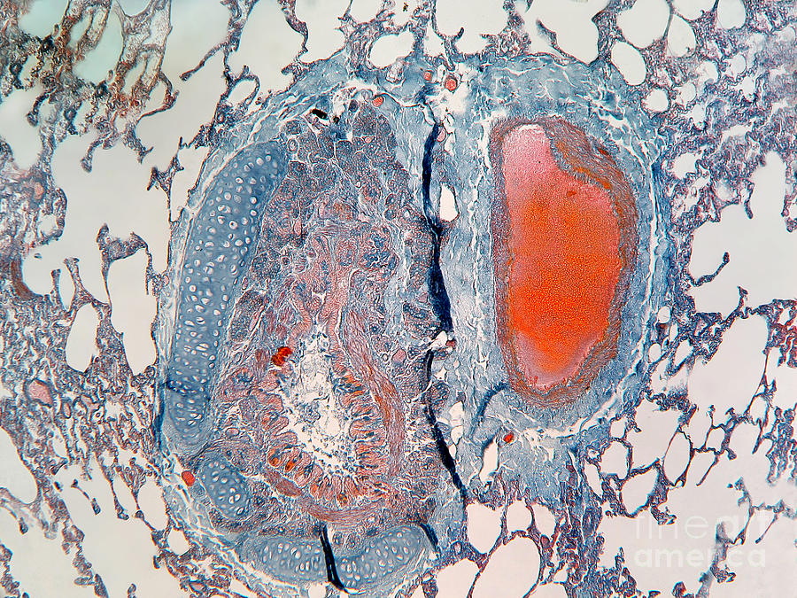 Lung Tissue Of A Cat Lm #1 Photograph by Garry DeLong