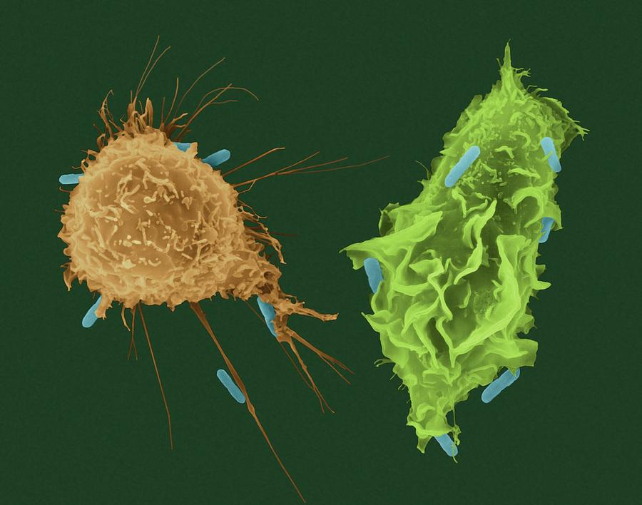 Macrophage And Monocyte Phagocytosis #1 Photograph by Dennis Kunkel Microscopy/science Photo Library