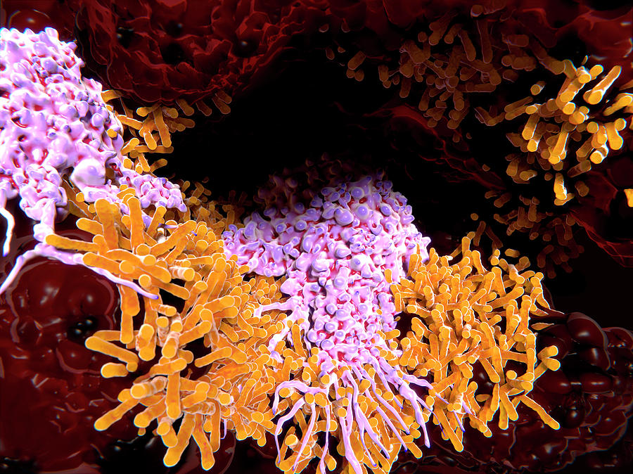 Macrophages In Tuberculosis #1 Photograph by Juan Gaertner