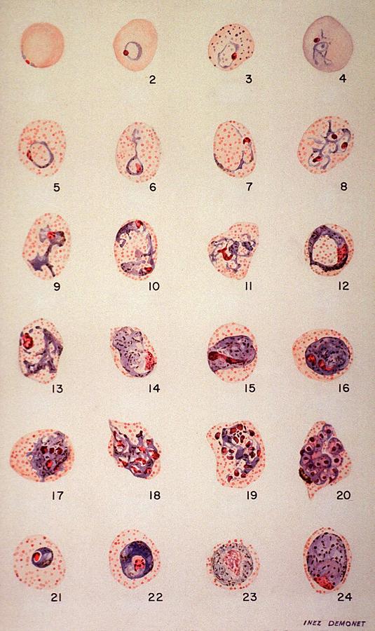 Malaria Parasite Growth Photograph by National Library Of Medicine ...