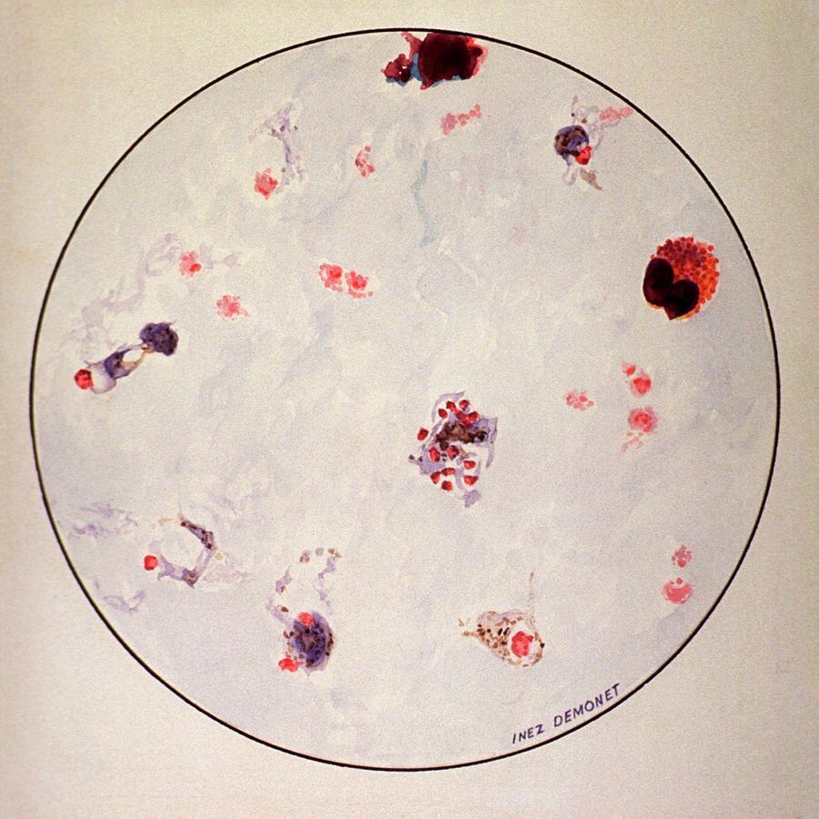 Malaria Parasite #1 Photograph by National Library Of Medicine