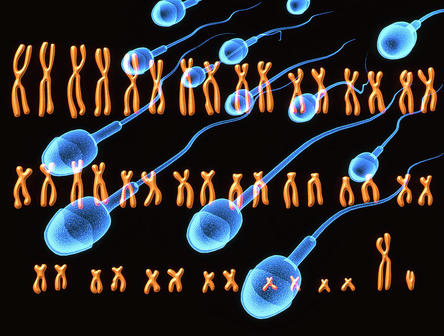 В гаплоидных клетках человека 23. Набор хромосом сперматозоида. Хромосомный набор человека. Бесплодие на клеточном уровне. Роль y хромосомы при мужском бесплодии.