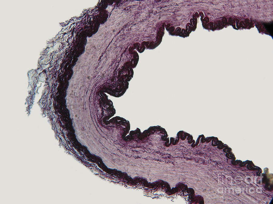 Mammalian Artery Lm #1 Photograph by Garry DeLong