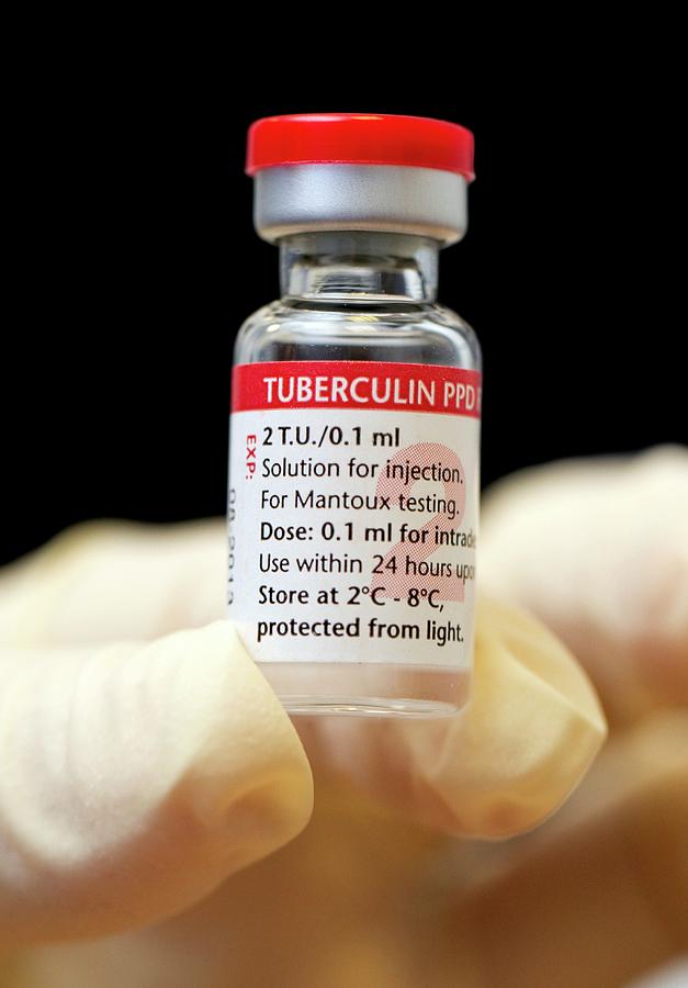 Tuberculin Photograph - Mantoux Solution #1 by Mark Thomas/science Photo Library