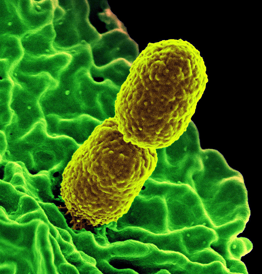 Mdr Pathogen, Klebsiella Pneumoniae, Sem #1 Photograph by Science Source