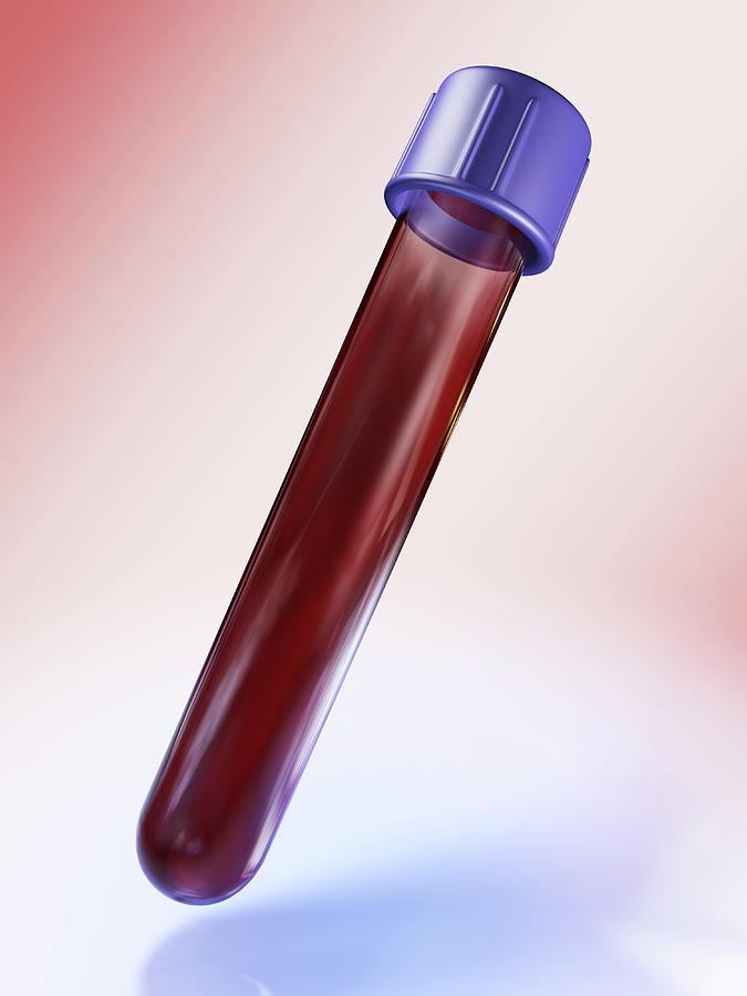Medical Test Tube With Blood #1 Photograph by Alfred Pasieka/science Photo Library