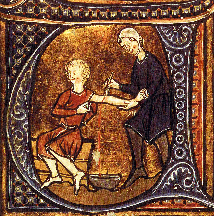 Medieval Bloodletting #1 Photograph by Science Source