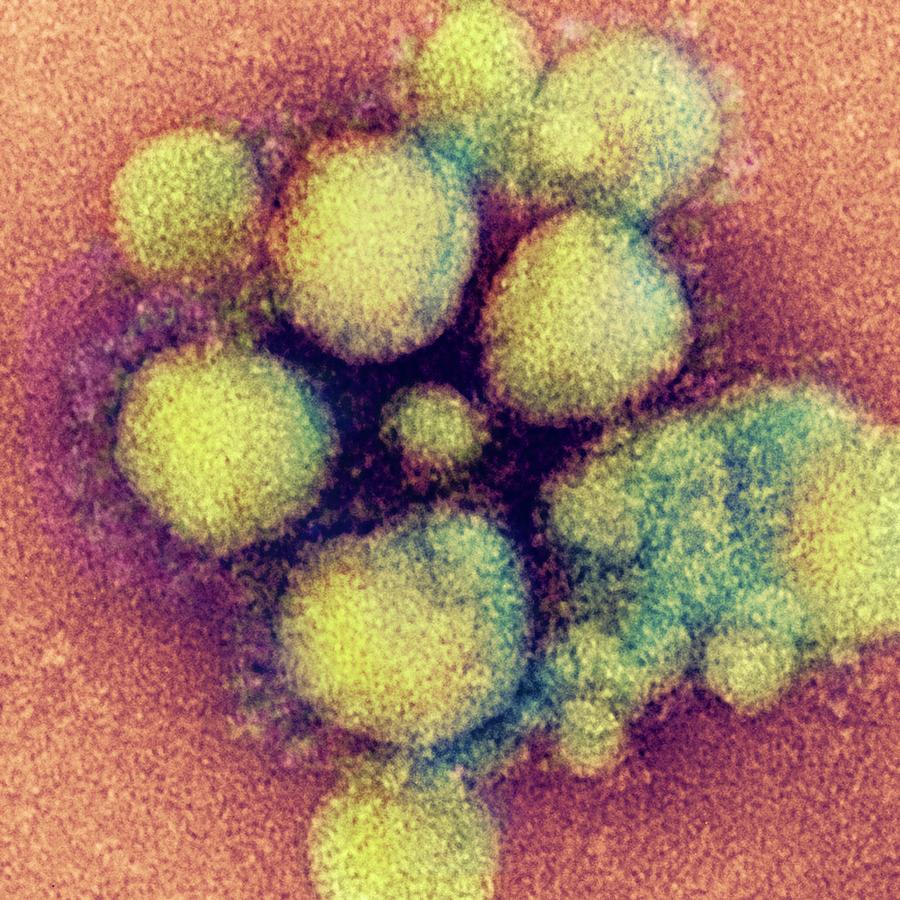 Mers Coronavirus #1 Photograph by Ami Images