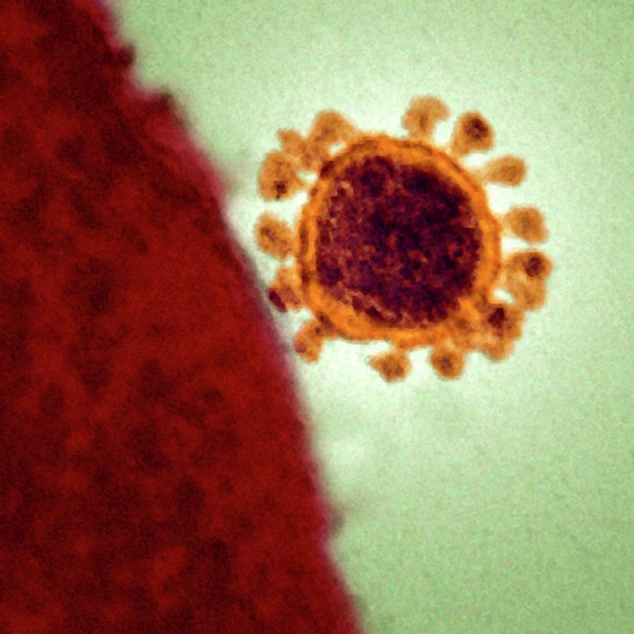 Mers Coronavirus Particle #1 Photograph by Ami Images