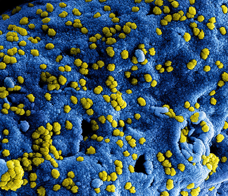 Mers Coronavirus Particles, Sem #1 Photograph by Science Source