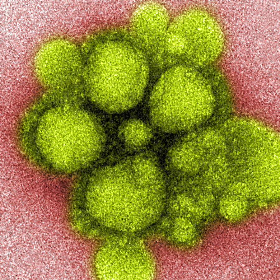 Mers-cov Middle East Respiratory #1 Photograph by Science Source