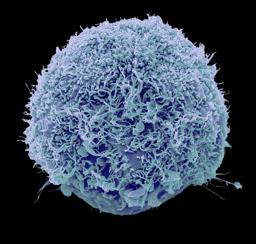 Mesenchymal stem cell, SEM #1 Photograph by Science Photo Library