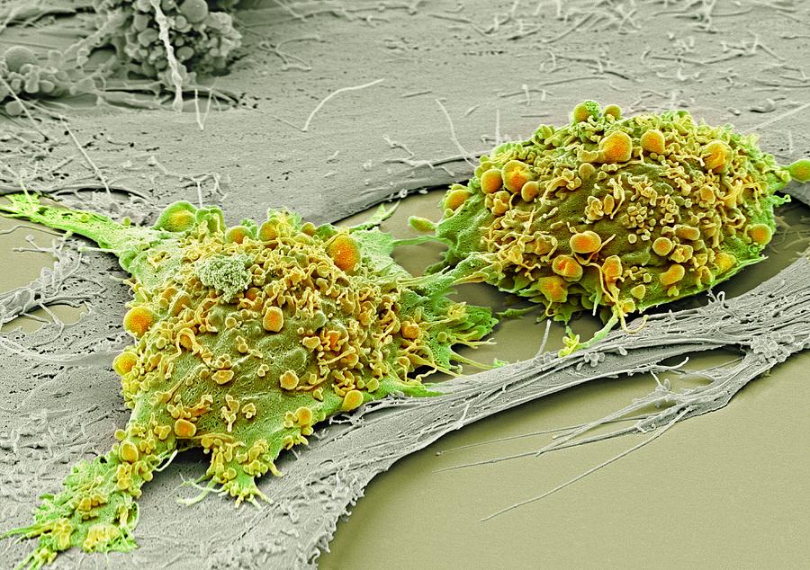 Anatomical Photograph - Mesenchymal stem cells, SEM #1 by Science Photo Library
