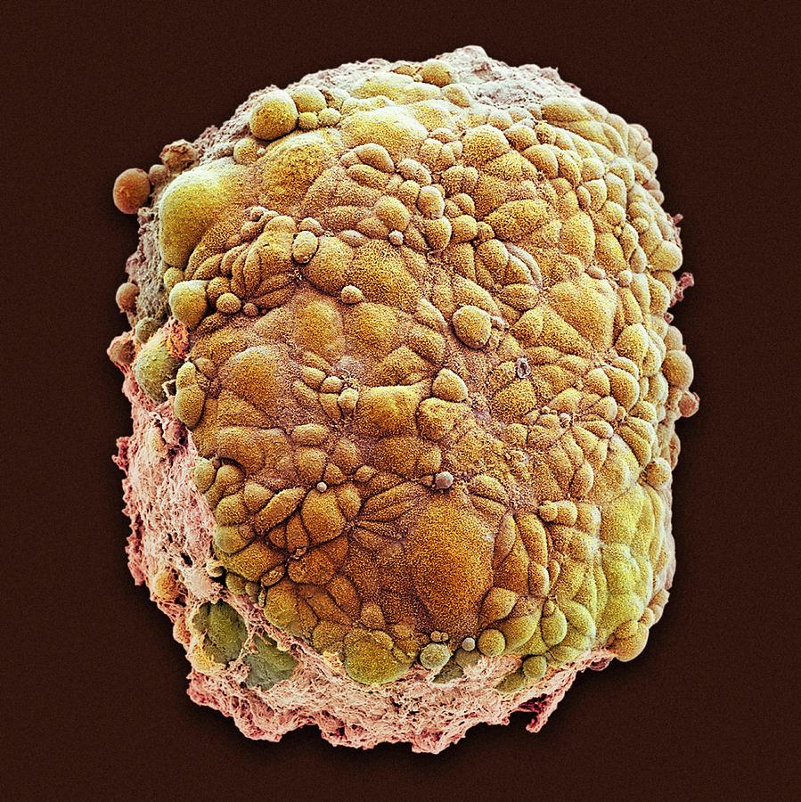 Mesothelioma Spheroid #1 Photograph by National Cancer Institute/science Photo Library