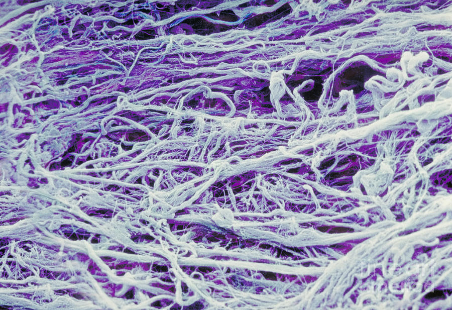 Microscope Image Of Collagen Fibers #1 Photograph by David M. Phillips