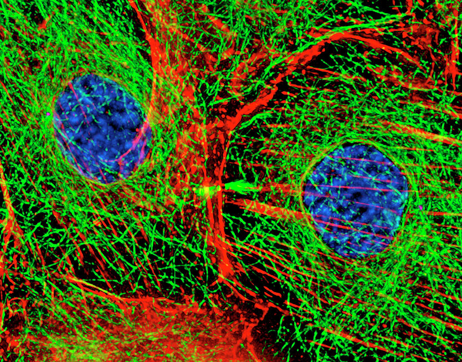 Mitosis Cell Division #1 Photograph by Dr Alexey Khodjakov/science Photo Library