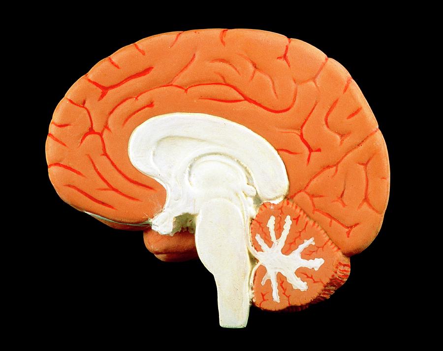 Model Of A Section Through A Healthy Human Brain Photograph by Pascal