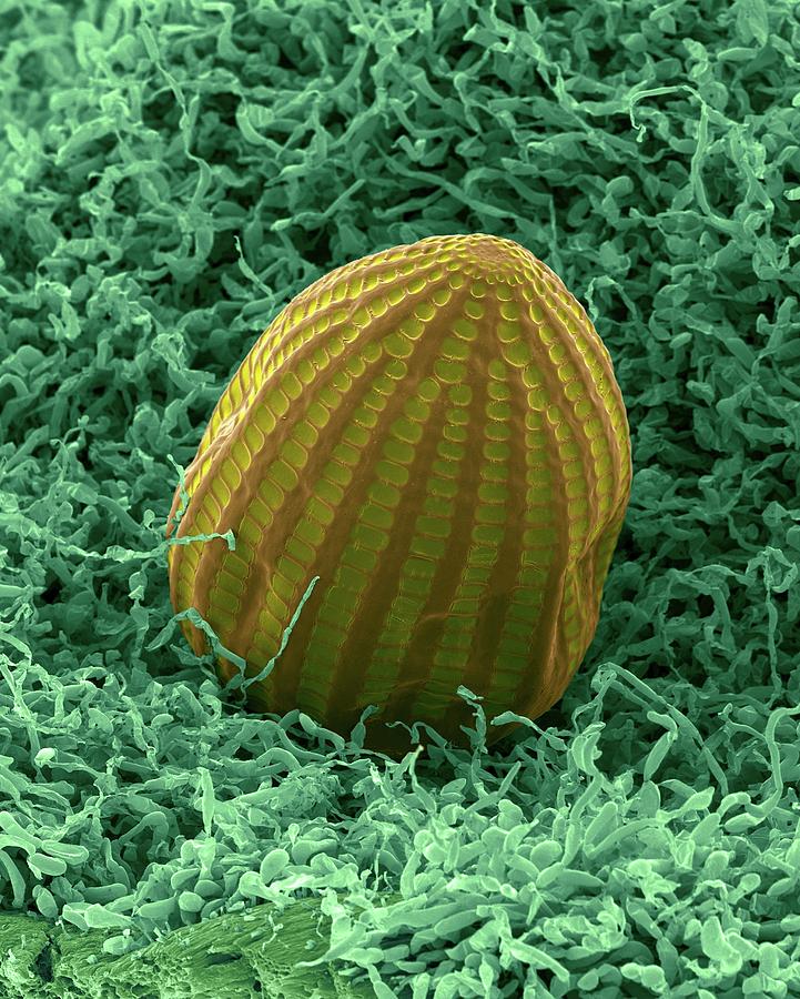 Monarch Butterfly Egg #1 Photograph by Dennis Kunkel Microscopy/science Photo Library