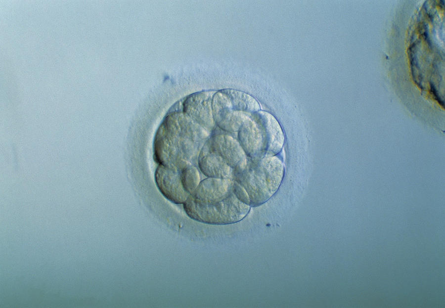 Morula Embryo #1 Photograph by Pascal Goetgheluck/science Photo Library