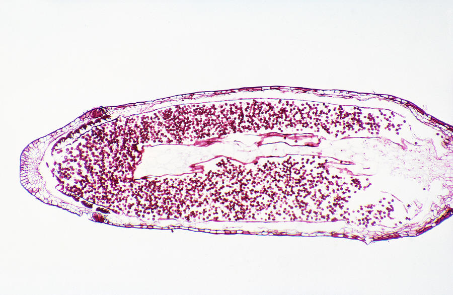 Moss Capsule #1 Photograph by Robert Knauft / Biology Pics