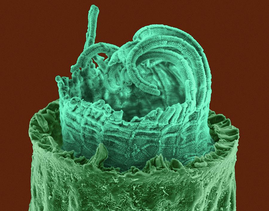 Moss Spore Capsule #1 Photograph by Dennis Kunkel Microscopy/science Photo Library