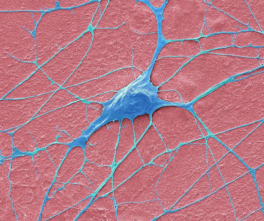 Motor Neurone #1 Photograph by Steve Gschmeissner