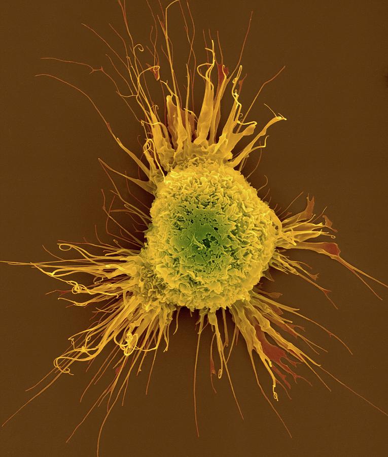 Mouse Dendritic Cell Photograph by Dennis Kunkel Microscopy/science ...