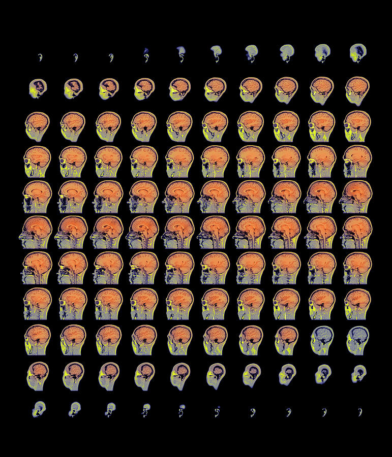 Mri Brain Scans #1 Photograph by Mit Ai Lab/surgical Planning Lab/brigham & Womens Hospital/science Photo Library