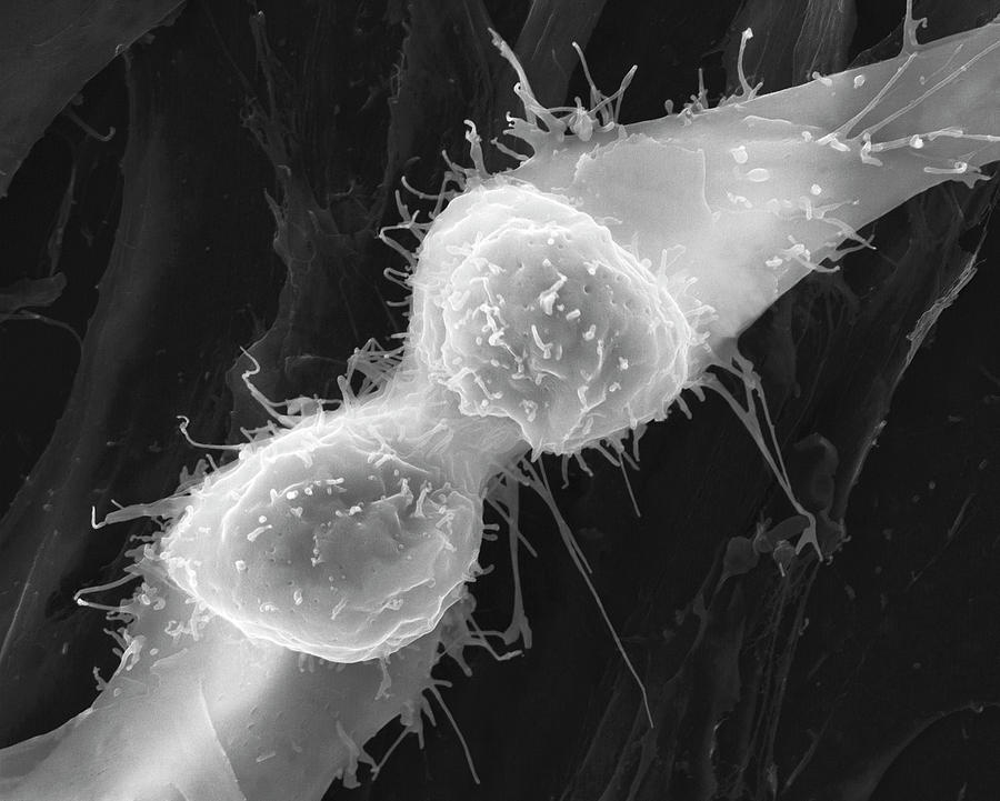Muscle Myoblast Dividing #1 Photograph by Dennis Kunkel Microscopy/science Photo Library
