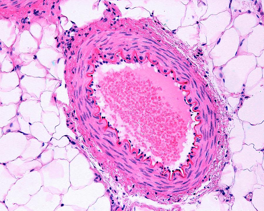 Arterias Musculares