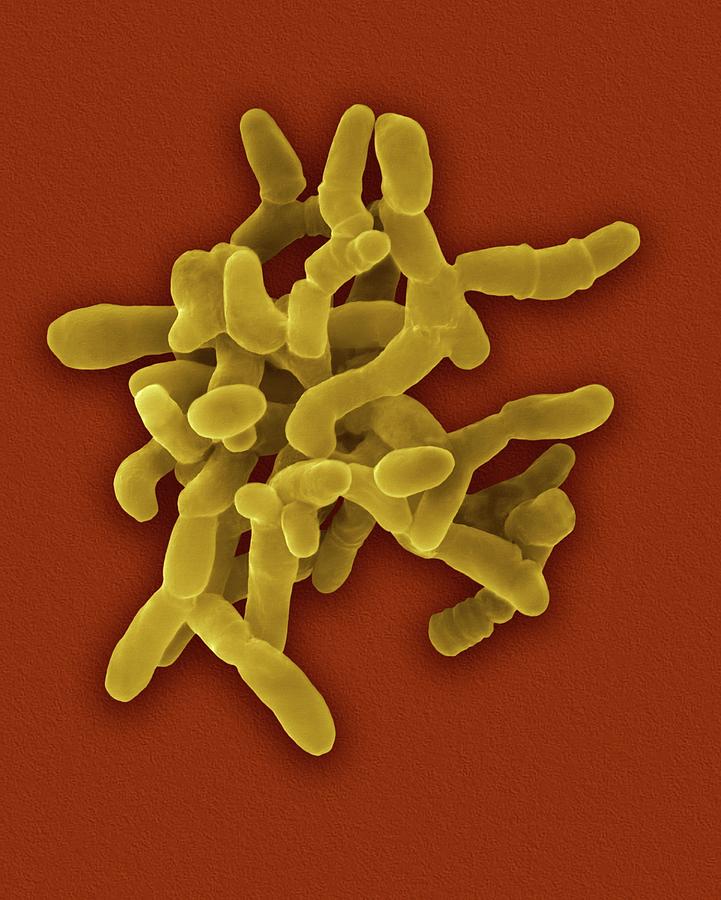 Animal Photograph - Mycobacterium Paratuberculosis Bacterium #1 by Dennis Kunkel Microscopy/science Photo Library