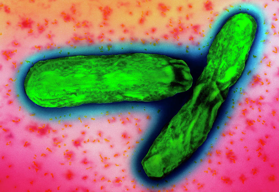 Mycobacterium Tuberculosis Bacteria Photograph By A Dowsett Health Protection Agencyscience