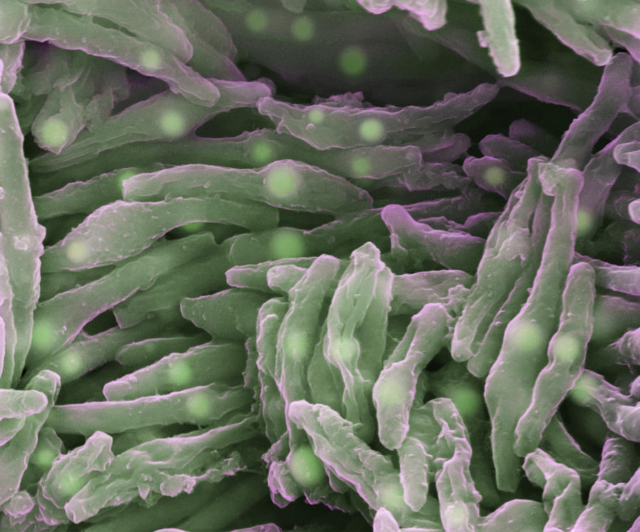 Mycobacterium Tuberculosis, Sem #1 Photograph by Eye of Science